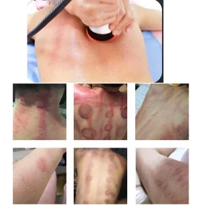 4 In 1 Ultrasonic Body Care Tool